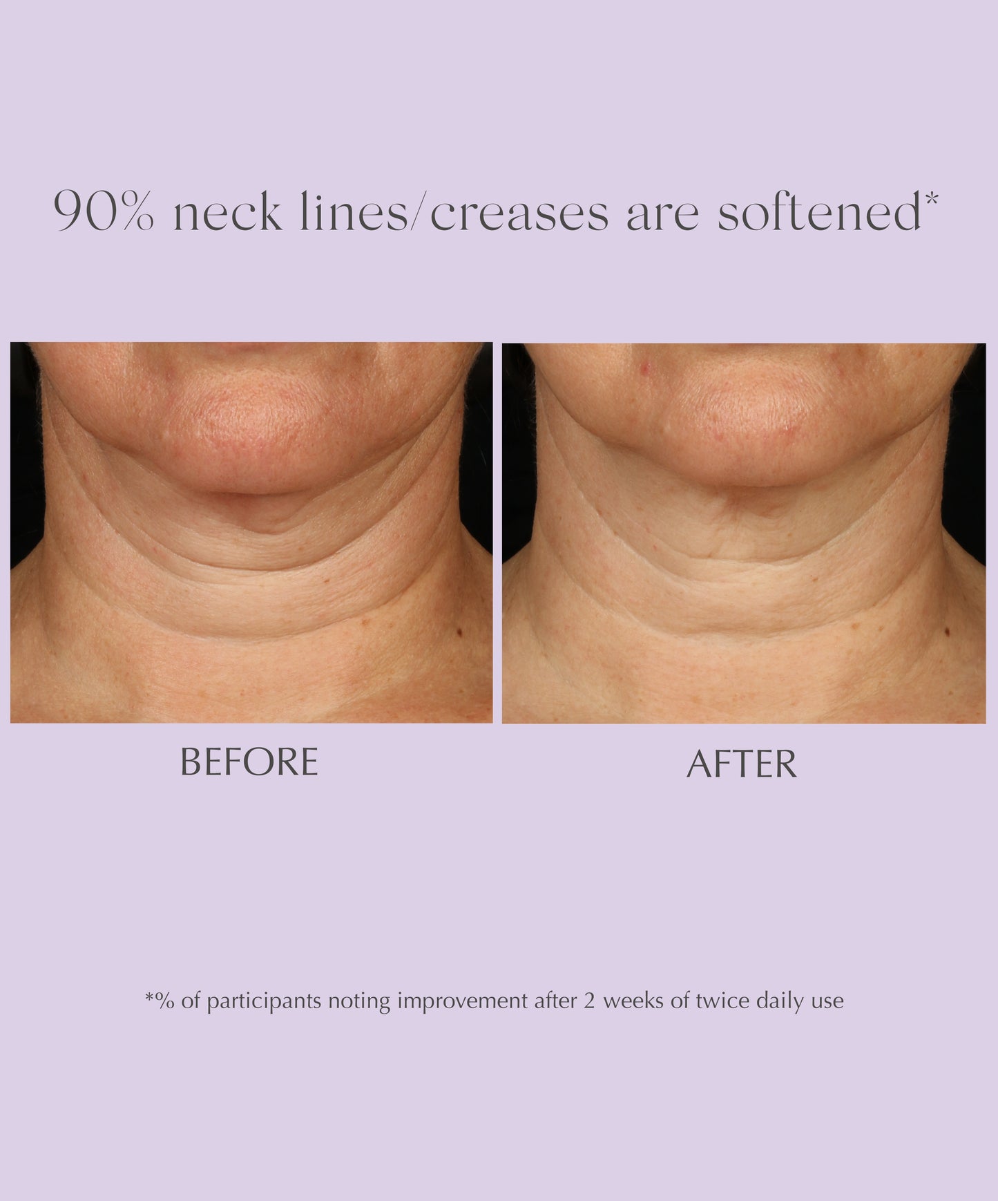 AGE REVERSE+ Toning Neck Cream