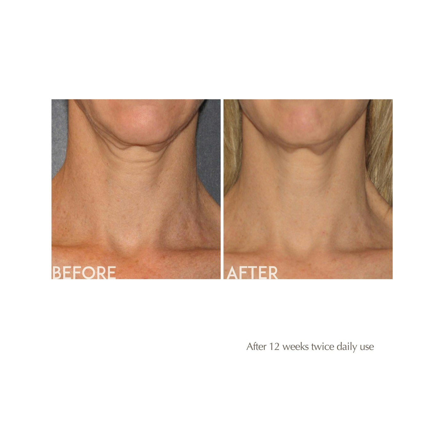 AGE REVERSE Toning Neck Cream