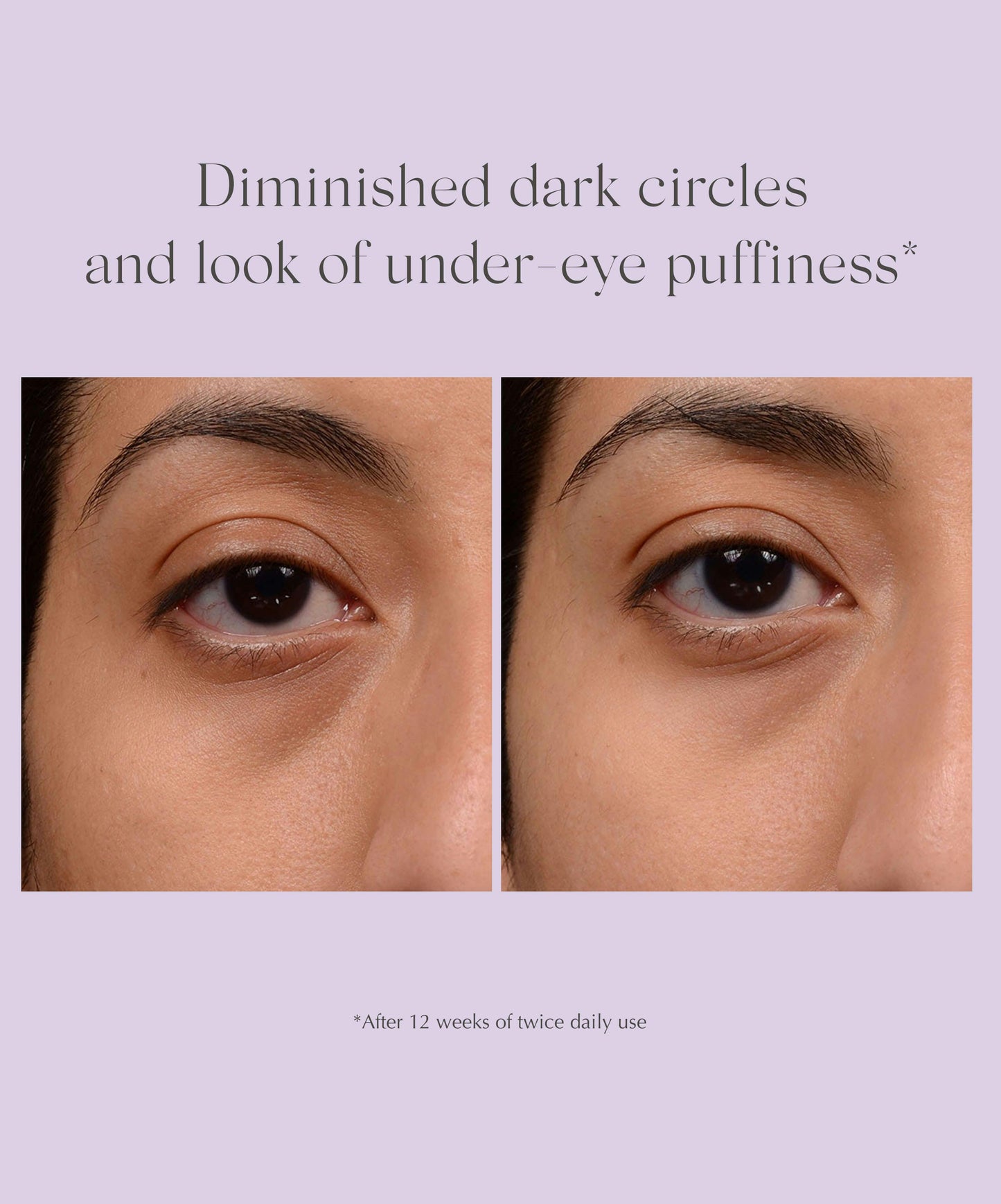 Bright Eyes Dark Circle Corrector