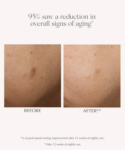 AGE REVERSE+ Advanced Renewal Retinol Serum