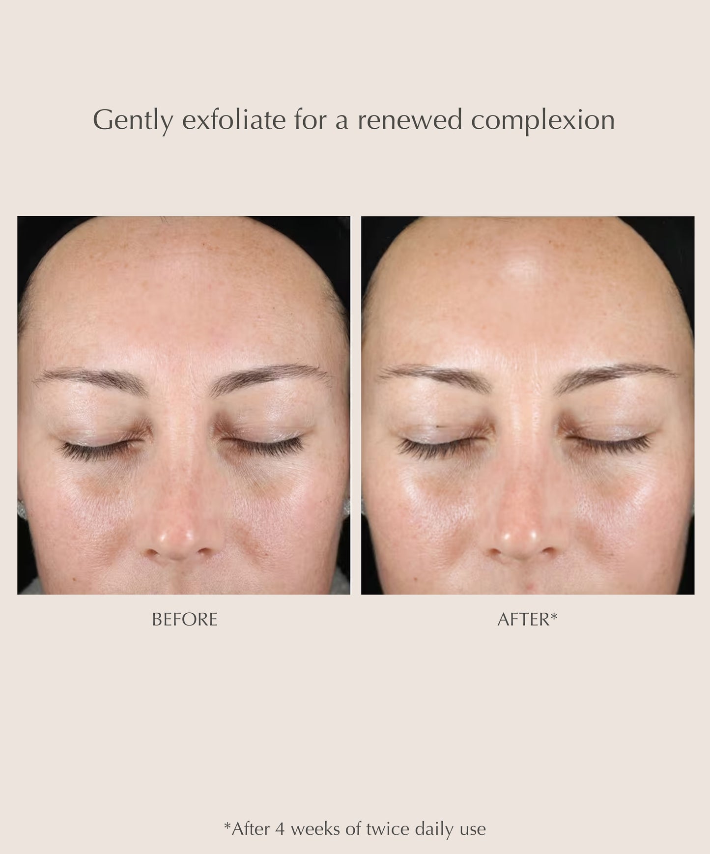 Gentle Daily Exfoliating Pads